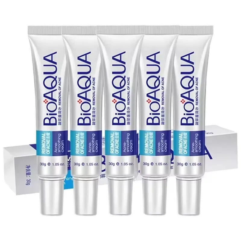 Acne Removal Cream – Anti Pimple & Dark Spot Treatment for Clear Skin