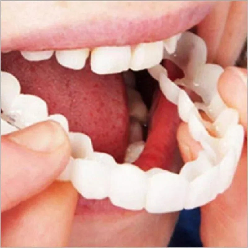Instant Smile Veneers | Temporary Cosmetic Teeth Cover for Perfect Smile