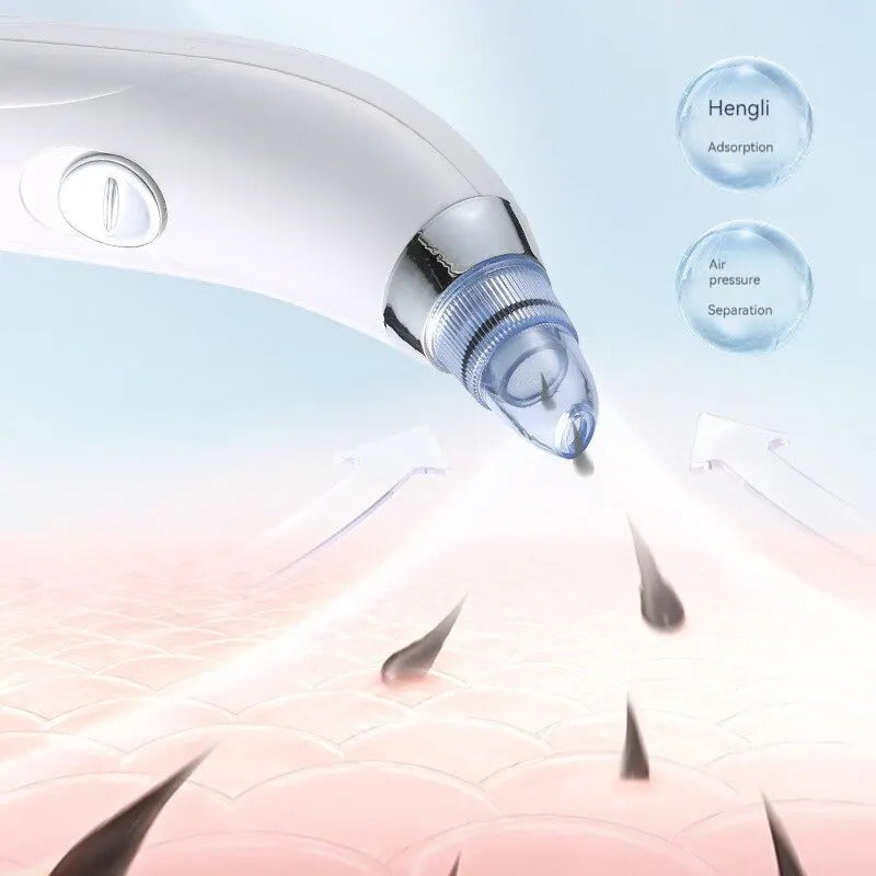 Derma Suction Blackhead Remover – Electric Pore Cleaner Vacuum with Adjustable Suction