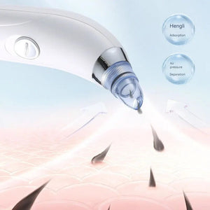 Derma Suction Blackhead Remover – Electric Pore Cleaner Vacuum with Adjustable Suction