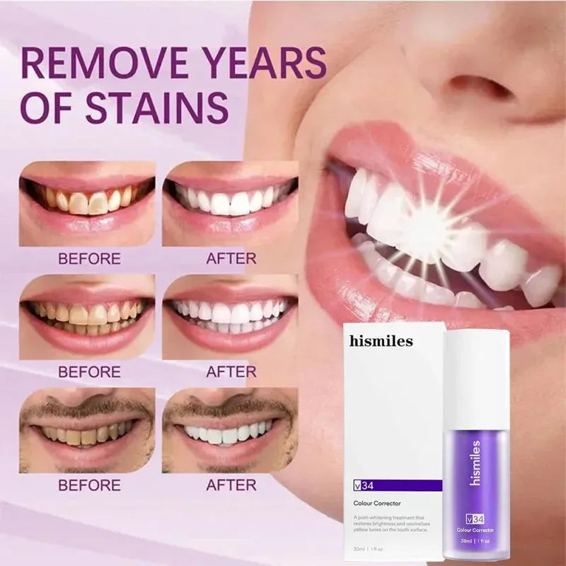 Hi Smile Teeth Whitening Serum – Purple Color Corrector
