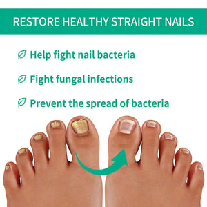 Nail Fungus Remover – Anti Fungal Nail Treatment Solution