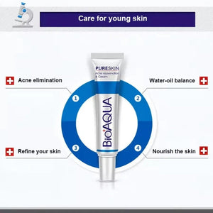 Acne Removal Cream – Anti Pimple & Dark Spot Treatment for Clear Skin