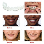 Instant Smile Veneers | Temporary Cosmetic Teeth Cover for Perfect Smile