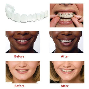 Instant Smile Veneers | Temporary Cosmetic Teeth Cover for Perfect Smile