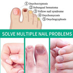 Nail Fungus Remover – Anti Fungal Nail Treatment Solution