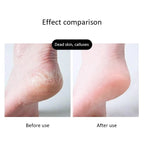Dual Side Foot Filer – Professional Pedicure Foot Scrubber for Callus & Dead Skin Removal
