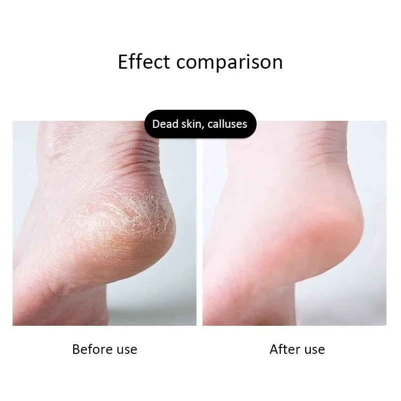 Dual Side Foot Filer – Professional Pedicure Foot Scrubber for Callus & Dead Skin Removal
