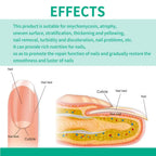 Nail Fungus Remover – Anti Fungal Nail Treatment Solution