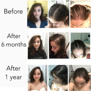 7 Day Ginger Hair Oil – Hair Growth, Anti Hair Fall & Strong Healthy Hair Solution