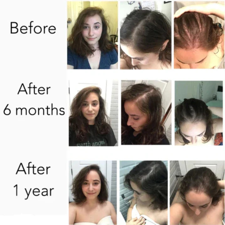 7 Day Ginger Hair Oil – Hair Growth, Anti Hair Fall & Strong Healthy Hair Solution