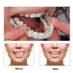 Instant Smile Veneers | Temporary Cosmetic Teeth Cover for Perfect Smile