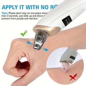 Electric Blackhead Remover Vacuum – Pore Cleaner & Acne Suction Device (5 Heads)