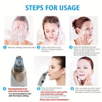 Electric Blackhead Remover Vacuum – Pore Cleaner & Acne Suction Device (5 Heads)