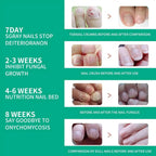 Nail Fungus Remover – Anti Fungal Nail Treatment Solution