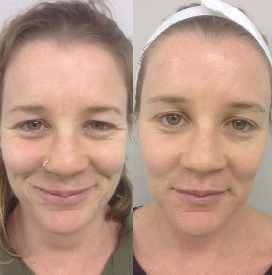 Comfort Grip Adhesive Heel Pads for Shoes