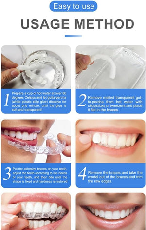 Snap On Smile Veneers Moldable False Artificial Braces Teeth Kits For Men And Women
