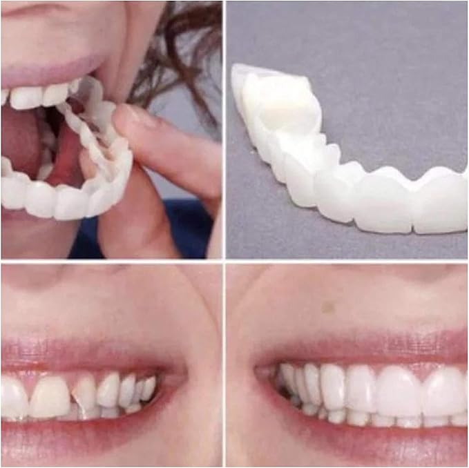 Snap On Smile Veneers Moldable False Artificial Braces Teeth Kits For Men And Women