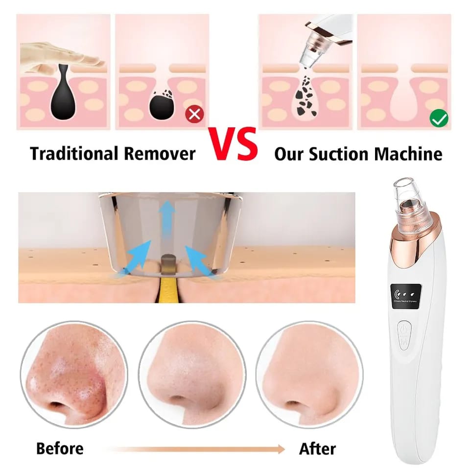 Multifunctional Cleaning Instrument For Pore Acne Pimple Removal and Vacuum Suction Facial Pore Cleaner