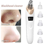 Multifunctional Cleaning Instrument For Pore Acne Pimple Removal and Vacuum Suction Facial Pore Cleaner