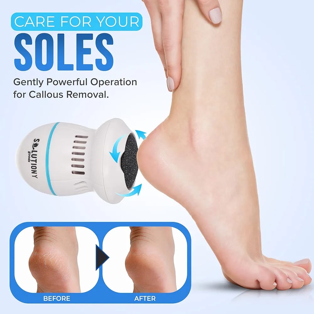 Portable USB Rechargeable Electric Callus Remover for Feet with Built in Vacuum Removes Dead Skin from Foot