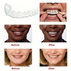 Snap On Smile Veneers Moldable False Artificial Braces Teeth Kits For Men And Women